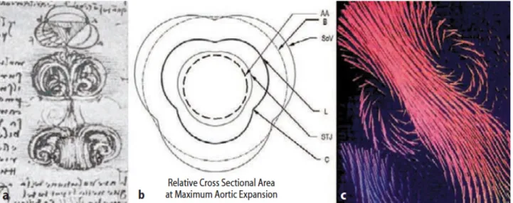 Fig. 8:  Aspetti della valvola aortica e dei vortici. A) disegni di Leonardo da Vinci
