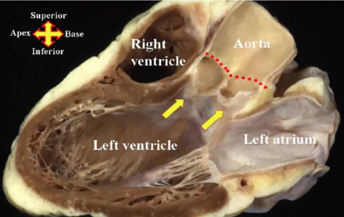 Fig. 1:  Questa immagine anatomica replica la fnestra ecocardiografca parasternale asse  lungo e mostra come l'aortic root risulti essere il perno centrale dell'organo cardiaco