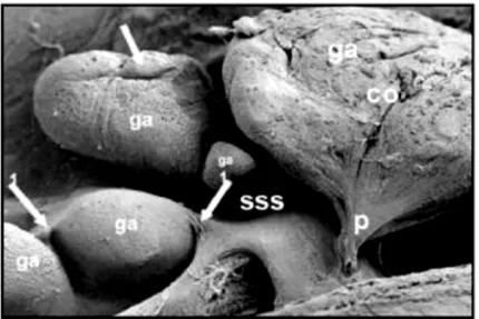 Figura  10  –  Fotografia  al  microscopio  elettronico  a  scansione  del  pavimento  del  seno   sagittale  superiore;  osservare  la  presenza  delle  granulazioni  del  Pacchioni