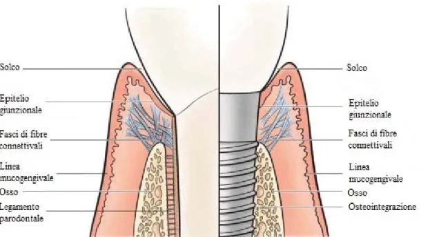 Fig. 1.4  Differenze tra dente e impianto nell’attacco dei tessuti molli circostanti. Mentre nel sito dentale le fibre  dell’attacco sopralveolare si inseriscono nel cemento radicolare, a livello del sito implantare vi sono fibre  equiva-lenti che decorron