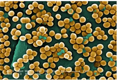 Figura 9: Cellule di Staphylococcus aureus (microscopio elettronico)  (http://biodiversipedia.pbworks.com) 