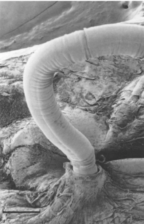 Fig. 2.8 – Immagine al microscopio elettronico a scansione di una larva di  Anisakis simplex penetrata  nel tessuto di stomaco umano in vitro (Sakanari J.A