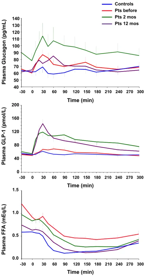 Figure 4. Time course of plasma glucagon, GLP-1, and FFA concentrations during the mixed meal in nondiabetic control subjects and diabetic patients before and 2 and 12 months after biliopancreatic diversion