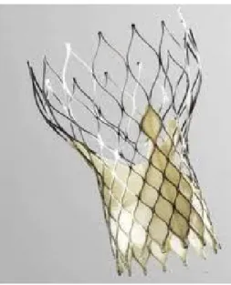 Figura  -12-  Protesi  aortica  percutanea  CoreValve:  la  struttura  a    maglie    (frame)  costituice  il  supporto della valvola protesica, che è posta al suo interno