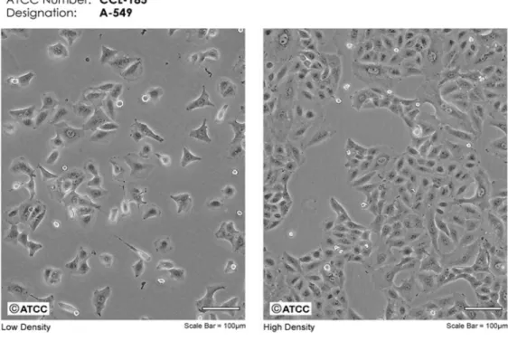 Figura 13 Morfologia  delle cellule A549 a bassa (destra) e alta (sinistra) densità di crescita 