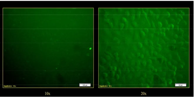 Figura 27 Cellule A549 non trattate (controllo). Le immagini sono ottenute con obiettivo 10X (a  sinistra) e 20X (a destra) 