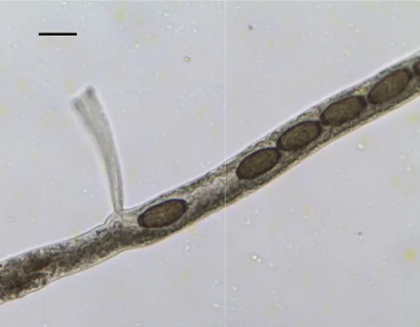 Fig. 27. Male of Trichuris vulpis