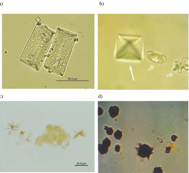 Figura 8.1 Esempi delle tipologie di cristalli più comunemente rinvenuti nel  sedimento  urinario  dei  piccoli  animali:  (a)  struvite;  (b)  ossalato  di  calcio  diidrato  (frecce  chiuse)  e  monoidrato  (frecce  aperte);  (c)  bilirubina;  (d)  urato