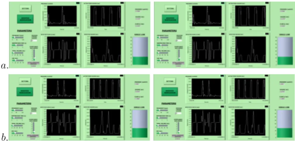 Figura 3.10: Esempi di GUI con simulazione di ventilazione assistita in differenti modalità: a