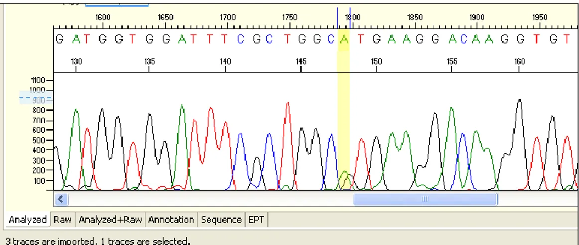 Figura 24. In giallo è evidenziata la base interessata dallo SNP (nucleotide 148). Il  campione sequenziato è eterozigote G/A, come indicato dalla presenza di due picchi  sovrapposti