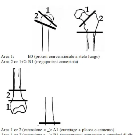 Tab. 3 Trattamento consigliato per le lesioni metaepifisarie nei pz in classe 2 e 3