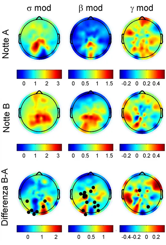 Fig 6 : modulazione delle attività rapide in banda sigma 12-16Hz, beta 16-25 Hz e gamma 25- 25-35  Hz  espressa  in  decibel