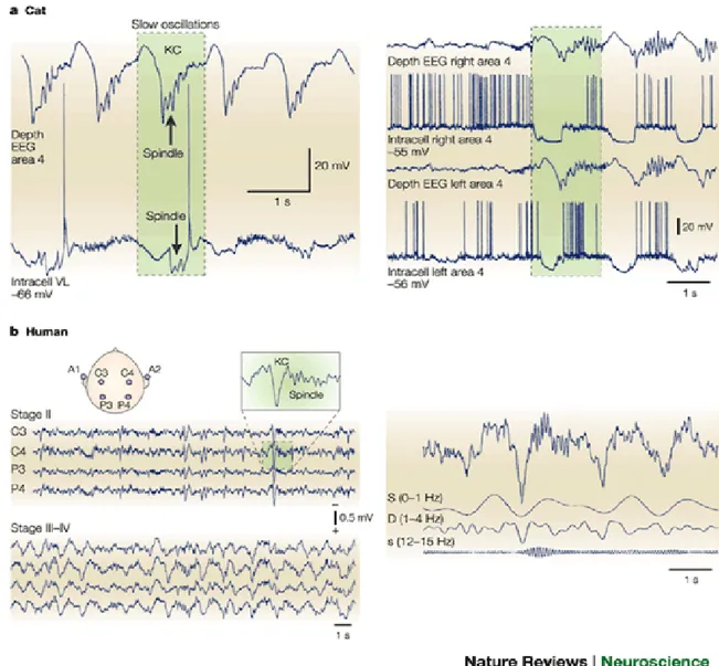Fig. 8 Steriade 2004 a) registrazioni intracellulari durante la fase NREM del sonno nel gatto, b)  registrazione EEG nell’uomo (stadio III e IV ) sonno NREM