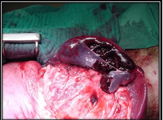 Figura 2.9: immagine di rottura di milza in seguito a torsione gastrica (foto del Dott