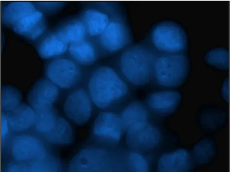 Figure  30:  HMTVenv-  MCF7  cell  line  (63X  oil  magnification  with  conventional fluorescence)