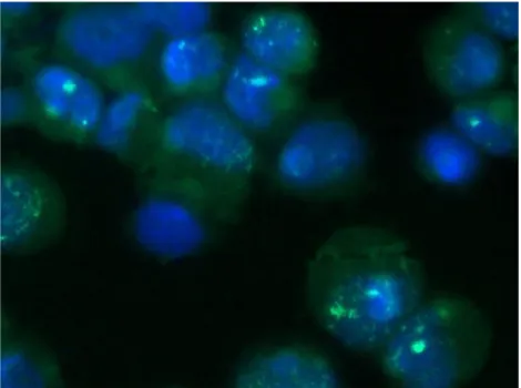 Figure 32: HMTVes+ primary breast cancer cell line (63X oil magnification  with  conventional  fluorescence)