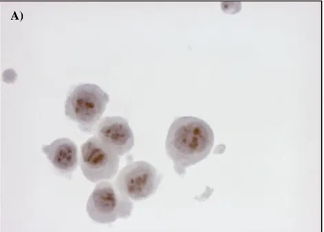 Figure 36 A): HMTVes+ primary breast cancer cell line and B) HMTVes-  MCF7 breast cancer cell line (60X magnification)