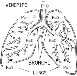 Figura 3.2. Paziente affetto da ostruzione  delle vie aeree distali (BPCO). Vengono  riportate le pressioni (P) nei diversi tratti  dell'albero bronchiale