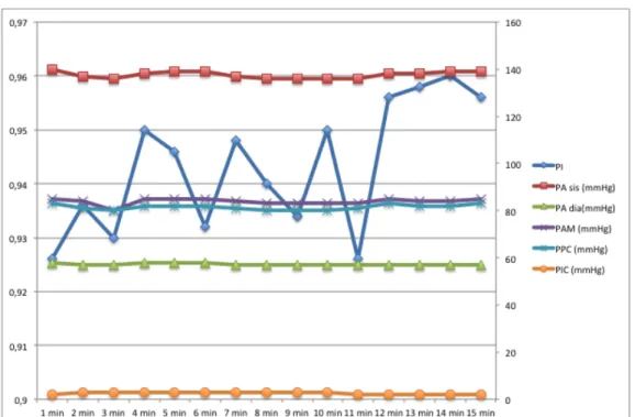 Fig 10: Pz 1. Visualizzazione del PI,SBP,DBP,MBP,PIC,PPC durante infusione di  Noradrenalina 