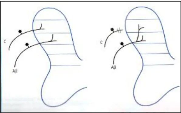 Fig. 1.2: processo di allodinia: sdoppiamento della fibra propriocettiva in L2 e sinapsi  con un afferente nocicettivo diverso dall’originale (Bufalari e Lachin, 2012).