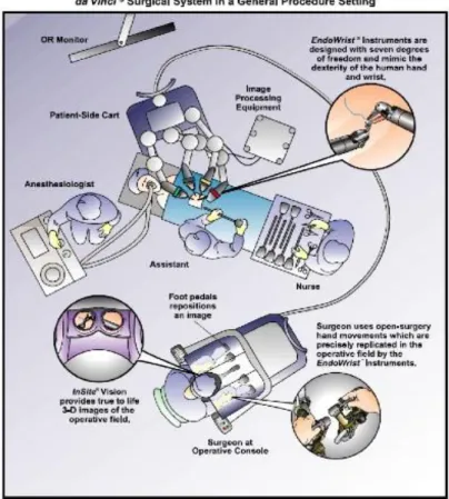 Figura 12 – Schema della sala operatoria dedicata al robot da Vinci 