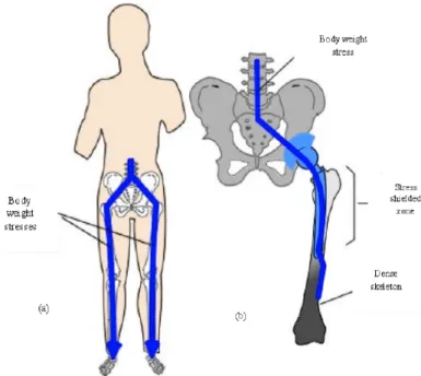 Fig.	
  2:	
   a)	
  distribuzione	
  fisiologica	
  delle	
  forze	
  di	
  carico.	
  	
  