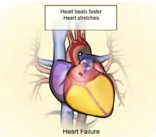 Figure 10. Hypertrophy during heart failure 