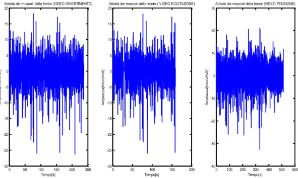 Fig. 18  Attività elettrica dei muscoli frontali durante la visione delle clip selezionate, partendo da sinistra 