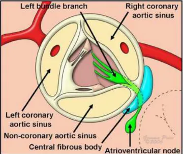 Fig. 4 L'illustrazione mostra la  localizzazione delle fibre di  conduzione atrio-ventricolari,  come vengono viste dal chirurgo  lungo l'aortic root