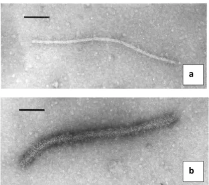 Figure 2. Particles of non-decorated (a) and decorated (b) Grapevine  Rupestris Stem Pitting-associated virus observed by Immunosorbent  electron microscopy (Petrovic et al., 2003) 
