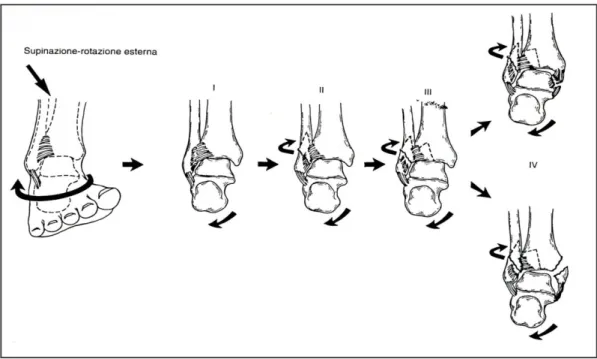 Fig. 5.3:movimento in supinazione-rotazione esterna; sequenzialità del danno al  progredire della forza
