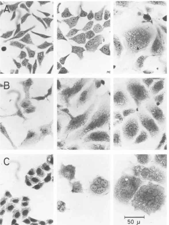FIG. 1. Toxin effect on monolayers of CHO (A), Vero (B). and HeLa (C) cells. From left to right, cells treated with: K-12 J53 cell extract, 18 h; ISS51 cell extract, 18 h: ISS51 cell extract, 3 days.