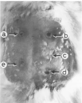 FIG. 4. Local reactions in rabbit 40 h after intra- intra-dermal injection (0.1 ml) of cell extracts obtained from ISS51 (a), ISS4 (b), K-12 J53 (c), ISS18 (d), and ISS2 (e).