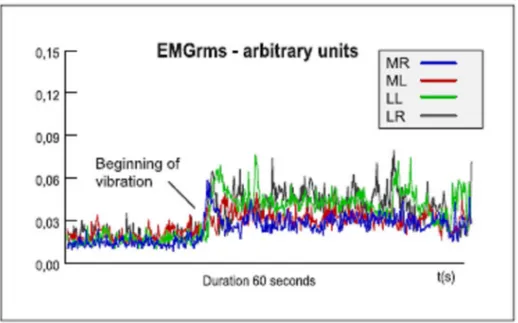 Fig.  4  Electromyografic  activity  (EMGrms)  recorded  from  leg  extensor  muscles (mm