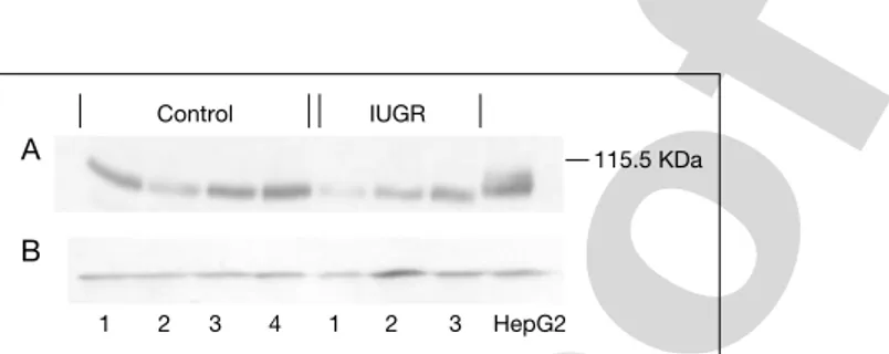 Fig. 4. Western immunoblotting for IR protein in human cytotrophoblasts of placentas from pregnancies complicated by intrauterine growth retardation and controls.
