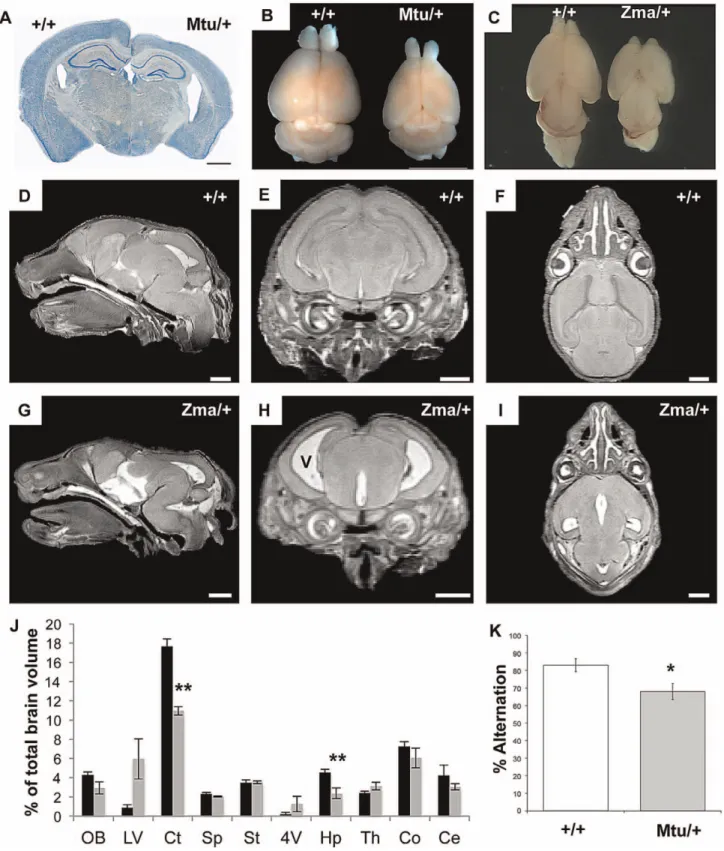 Figure 7. Brain size and behavioral abnormalities in Rps7 mutants. (A) A Nissl stained coronal section of a 5 month old Rps7 Mtu /+brain shows a thinner cortex and larger ventricles when compared to an Rps7+/+ littermate