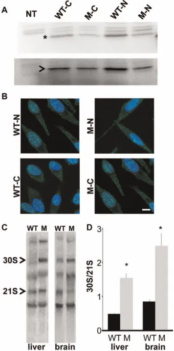 Figure 2. Rps7 Mtu shows reduced function in ribosomal precursor processing. (A) Western blot showing similar levels of expression for N- and C-terminal FLAG-tagged wild-type RPS7 (WT-N and WT-C, respectively) and RPS7 Mtu (M-N and M-C, respectively) prote