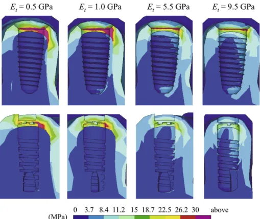Fig. 9. Von Mises stress contours on the cross-section at y = 0 for Branemark 1 (ﬁrst row) and Ankylos (second row) implants in mandibular segment versus trabecular Young’s modulus E t .