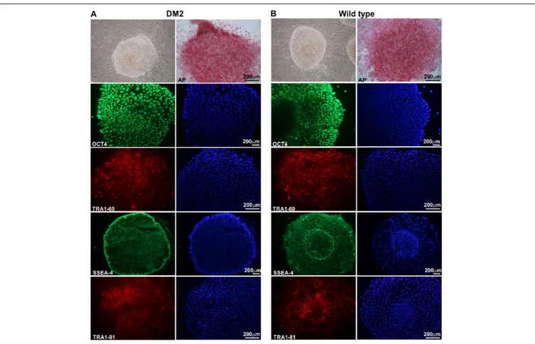 FIGURE 1 | Morphological and immunocytochemical analysis of human hiPSC clones. A representative image, obtained by phase-contrast microscopy, of hiPSCs derived from a DM2 patient (A) and from a wild type (WT) (B)