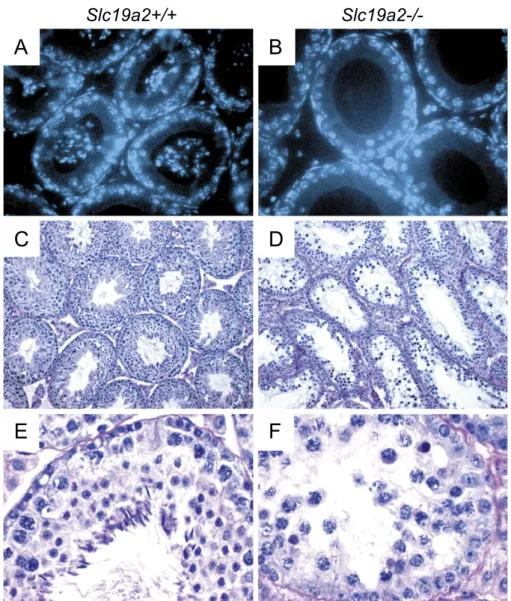 Fig. 2. Abnormal spermatogenesis in Slc19a2 / mice. (A, B) Cross-sections of DAPI-stained epididymes from 12-week-old Slc19a2 / and Slc19a2 +/ + mice revealed aspermia in Slc19a2 / males (original magnification 600  )