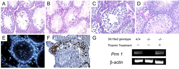 Fig. 6. Effects of thiamin deficiency and high-dose thiamin injection on spermatogenesis in Slc19a2 / mice
