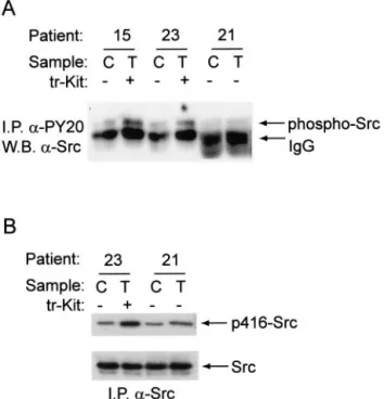 Figure 5. Phosphorylation of Src in tr-Kit-expressing prostatic tumors. Cell extracts (500 ␮g) from prostatic tumors (T) or contralateral prostate (C) were immunoprecipitated for 2 hours using 1 ␮g of either the  anti-phosphoty-rosine (␣-PY20) antibody (A)