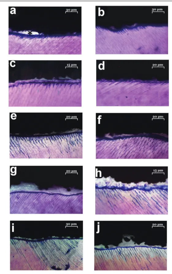 Fig. 1  Laser optical microscopy images of amalgam-dentin interface.