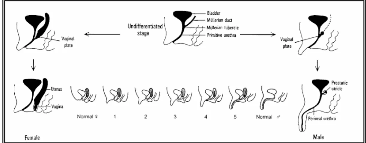 Figura 3. Differenziazione normale ed anomala del seno urogenitale e dei genitali esterni