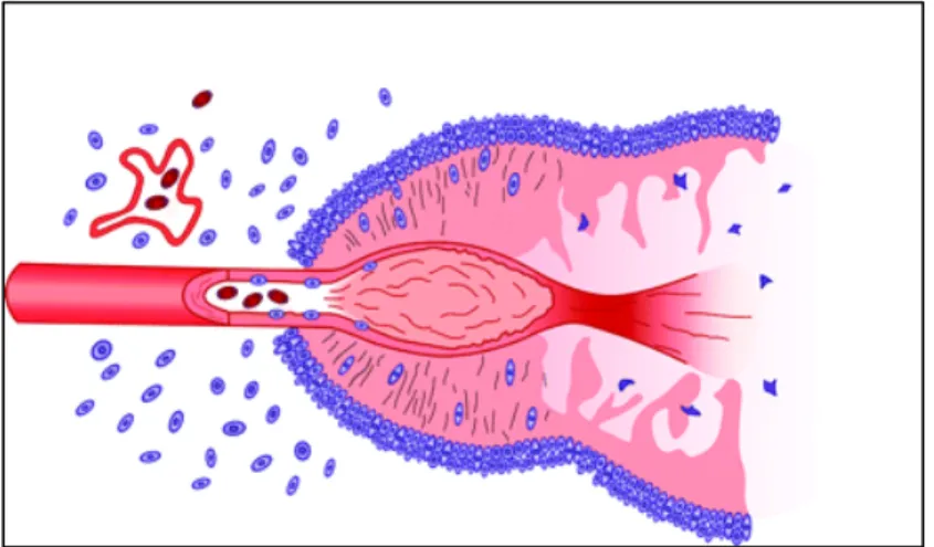 Figure 2. Schematic representation of the formation of a pseudopalisade. 