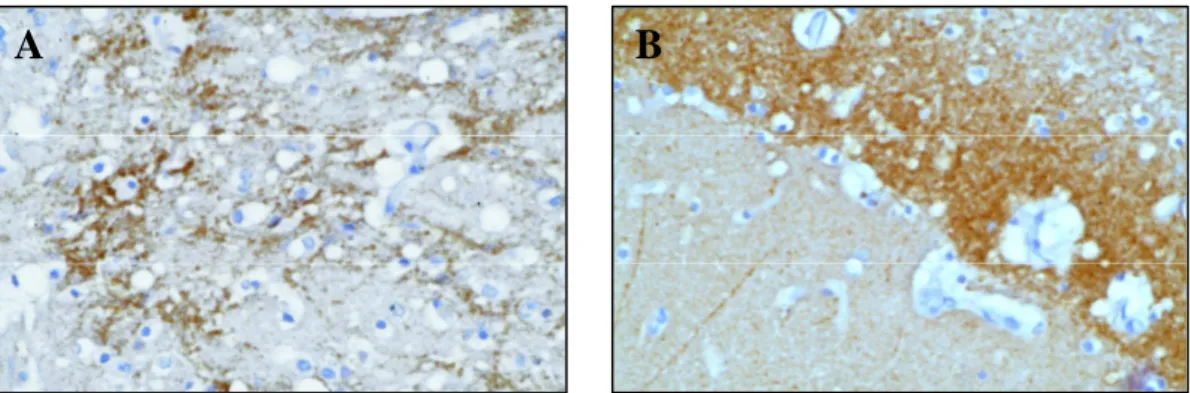 Fig. 1.2 – Depositi proteasi-resistenti di proteina prionica patologica (PrP EST ) rilevati  mediante  immunoistochimica  su  sezioni  di  talamo  (A)  ed  ippocampo  (B)  di  topo  sperimentalmente infettato con scrapie