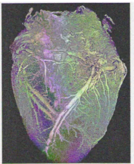 Figura 7 Immagine di cuore di maiale ottenuta con CT flat-panel sperimentale   (Da Desjardins B AJR 2004) 