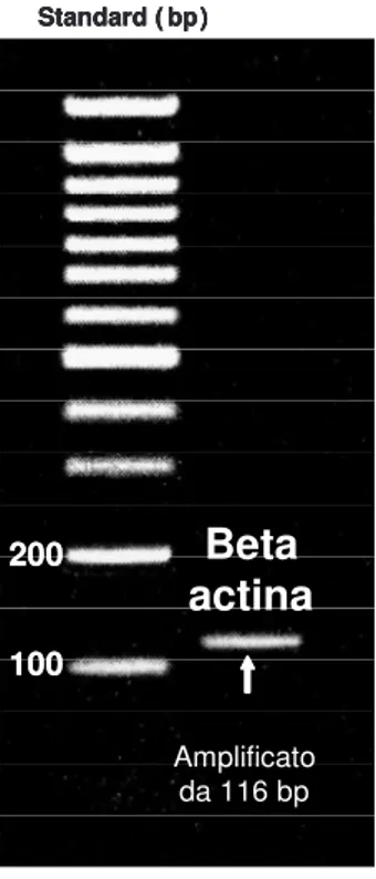 Fig.  3.3  Elettroforesi  su  gel  di  agarosio.  Prodotto  di  amplificazione del cDNA investigato, relativo alla beta actina 100200Standard ( bp)actinaBeta100200Standard ( bp) Amplificato da 116 bp100200Standard ( bp) actinaBeta100200Standard ( bp)Amplif