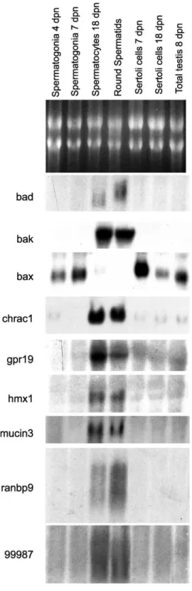 Fig. 2. Germ cell-type-specific expression of a selection of genes identified by Affymetrix microarray hybridizations was verified by Northern blot analysis, using 10 mg of total RNA for each indicated testicular cell type.