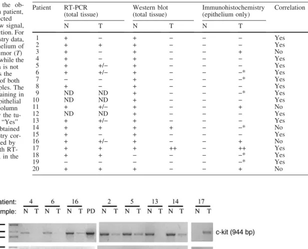 Fig. 1 C-KIT mRNA expression in colon carcinomas. c-KIT am- am-plification from representative samples using oligonucleotide  se-quences corresponding to exon 14 (forward primer) and exon 21 (reverse primer)